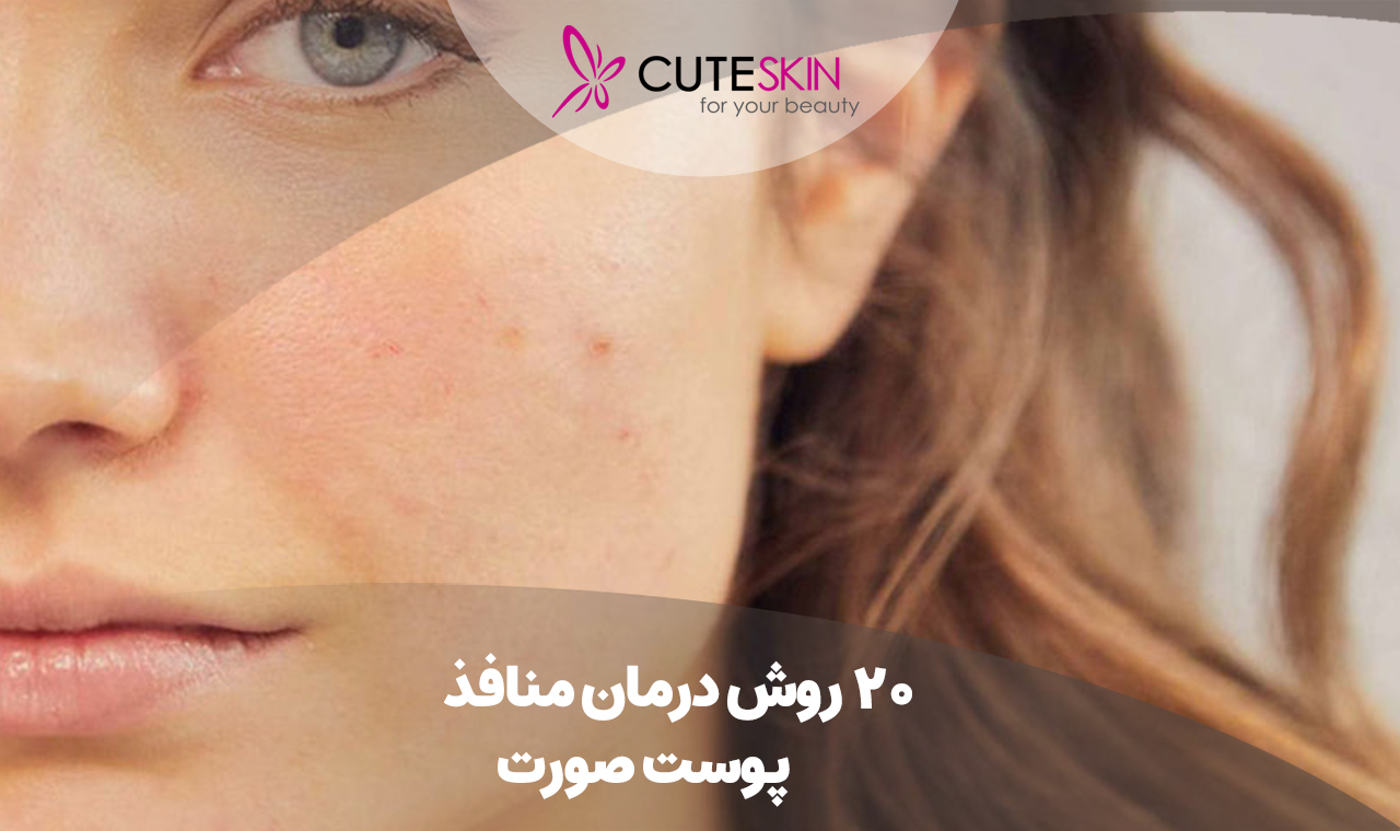 20 روش درمان منافذ پوست صورت