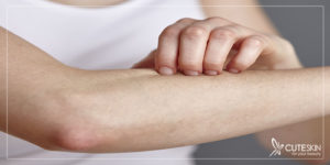 درمان خشکی پوست زانو و آرنج