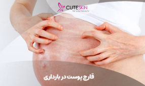 قارچ پوست در بارداری