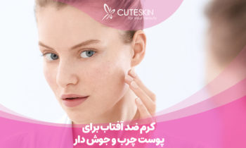 کرم ضد آفتاب برای پوست چرب و جوش دار