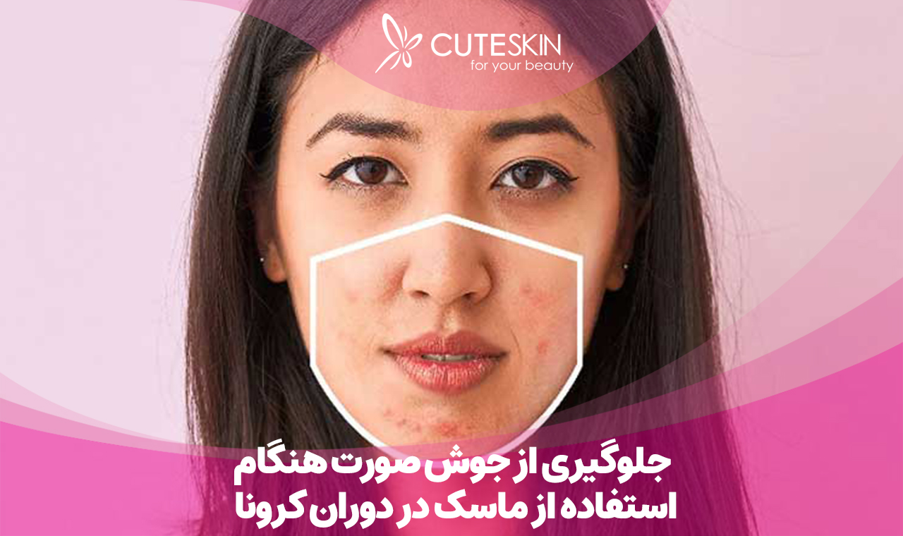 جلوگیری از جوش صورت هنگام استفاده از ماسک در دوران کرونا