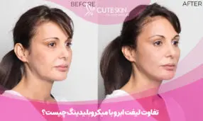 تفاوت لیفت ابرو با میکروبلیدینگ چیست؟