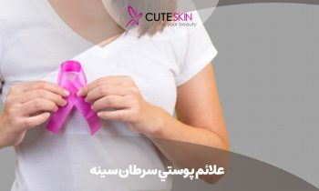 علائم پوستي سرطان سينه