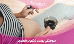 سوختگی پوست شکم در بارداری